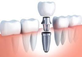 Prosthodontics