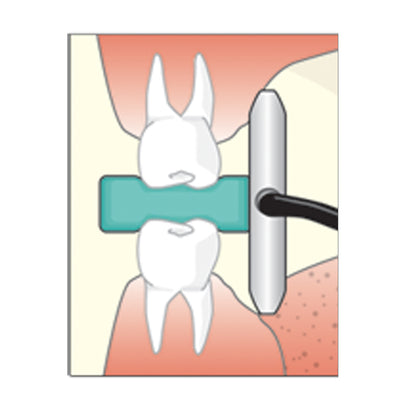 Flow Dental Sticky Bites Blocks for Intra-oral Imaging