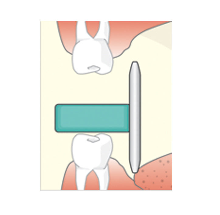 Flow Dental Sticky Bites Blocks for Intra-oral Imaging