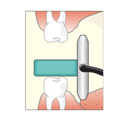 Flow Dental Sticky Bites Blocks for Intra-oral Imaging