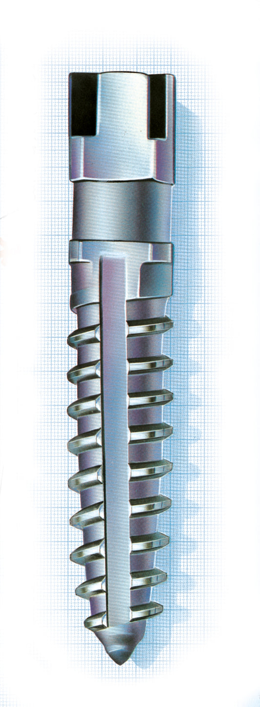 Ancorex Titanium Screw Posts Refills Small (S1-S6)