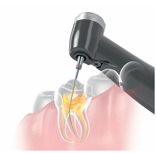 J. Morita Tri Auto ZX2+ Cordless Endodontic Handpiece With Apex Locator